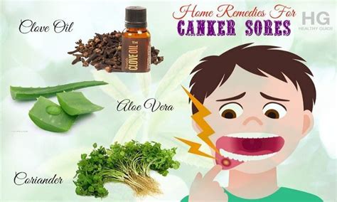 canker sores on tongue home remedies