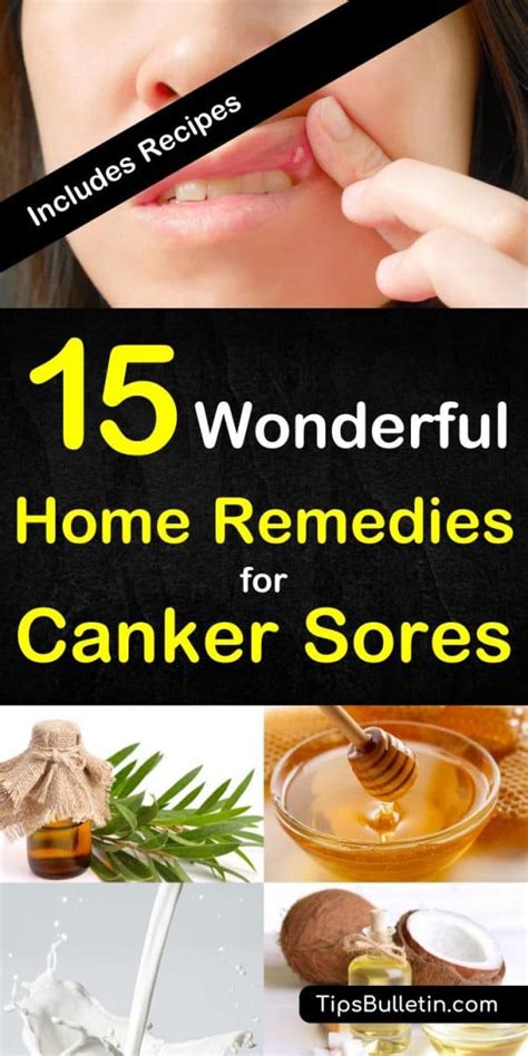 canker sores treatment