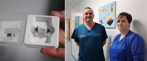capsule endoscopy camera