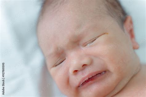caring for an infant with newborn tear duct obstruction