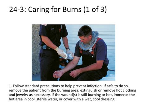 caring for burns
