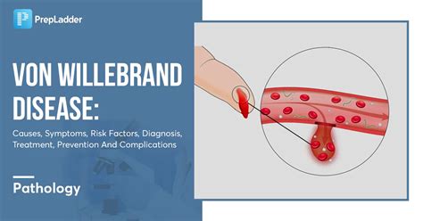 Causes and risk factors of von Willebrand disease