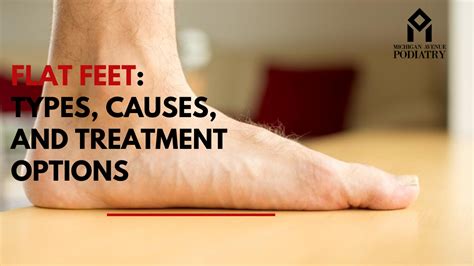 Causes of Flat Feet Image