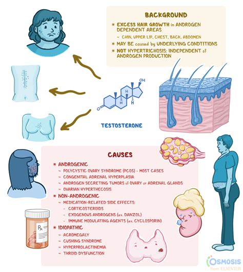 Causes of Hirsutism