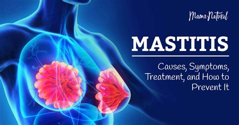 Causes of Mastitis