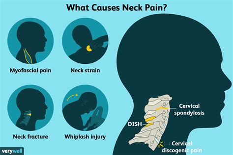 Causes of Neck Pain Under Jaw
