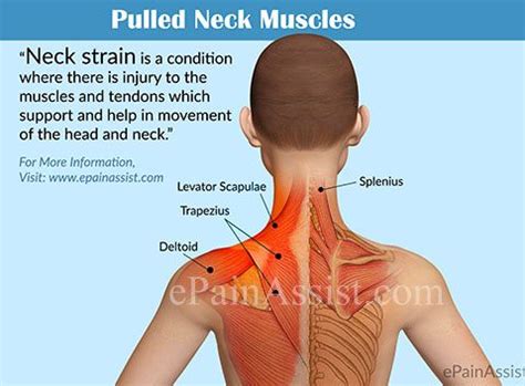 Causes of Neck Pulled Muscle Symptoms