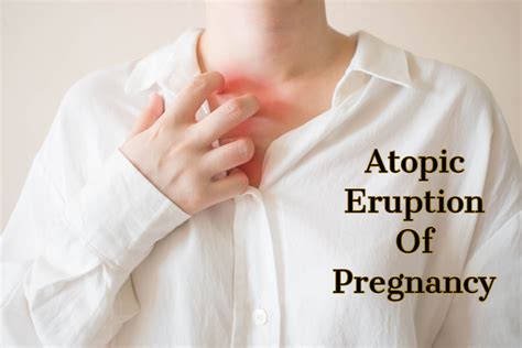 causes of pregnancy eruption