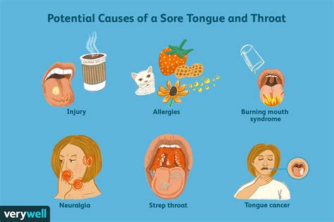 causes of sore throat