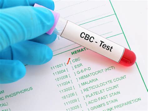 cbc blood panel test
