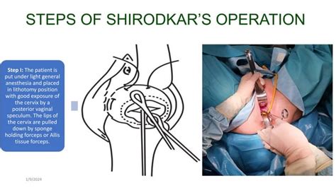 cervical cerclage procedure cost and insurance