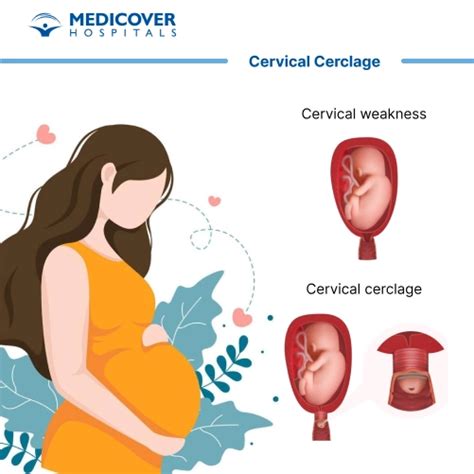 cervical cerclage procedure recovery