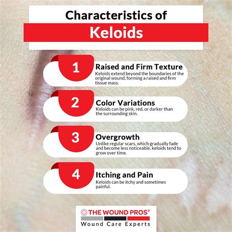Characteristics of Keloid Scars