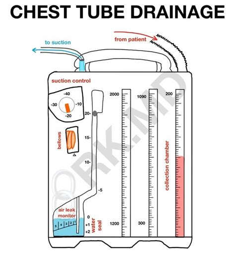 Chest Tube