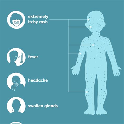 Diagnosis of Chickenpox