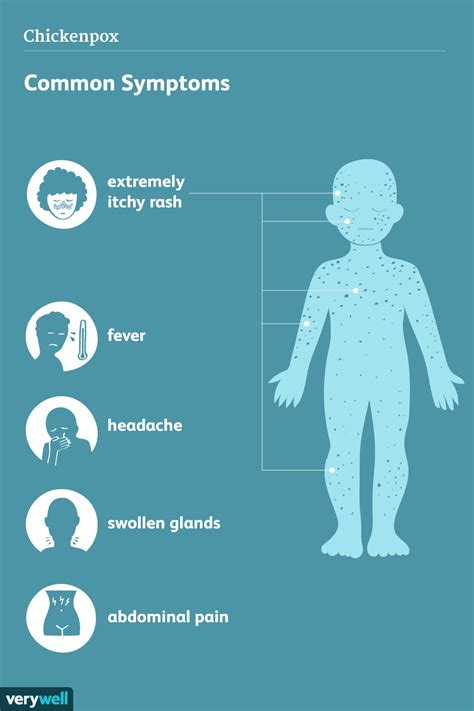 Symptoms of Chickenpox
