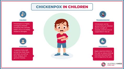 Transmission of Chickenpox