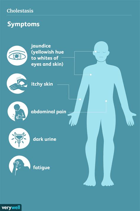 Cholestasis Symptoms