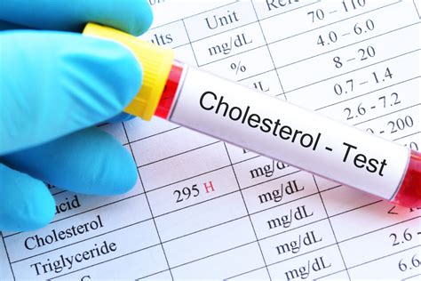 cholesterol check