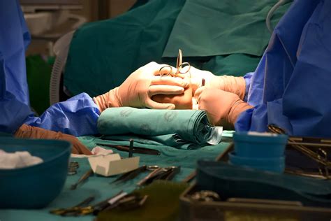 Circumcision procedure
