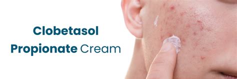 Benefits of Clobetasol Cream