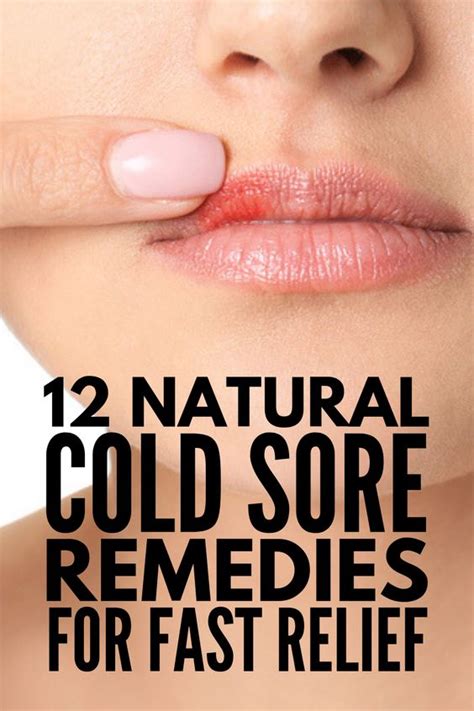 cold sore remedies