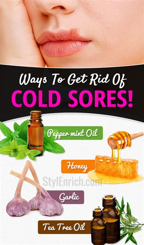 cold sore remedies