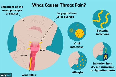 cold throat pain causes