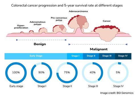 colon cancer detection