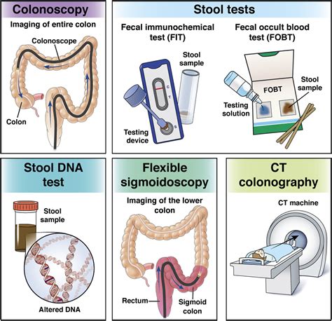 colon cancer test