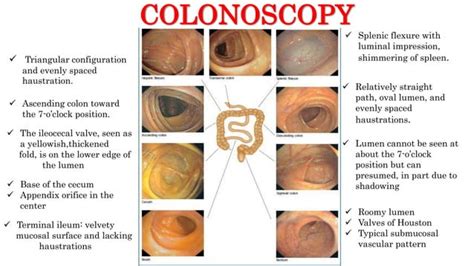 colonoscopy conclusion