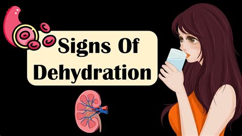 Common Dehydration Symptoms