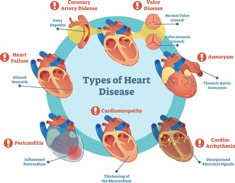 Common Heart Problems
