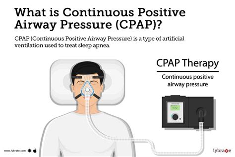 common misconceptions bilevel positive airway pressure