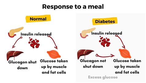 common mistakes that can disrupt glucose regulation