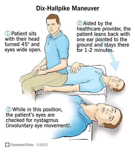 common mistakes to avoid when performing vertigo maneuver techniques