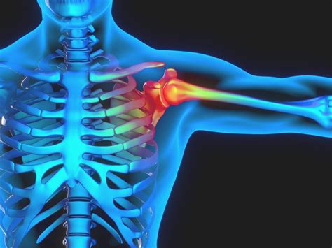 Common Shoulder Injuries