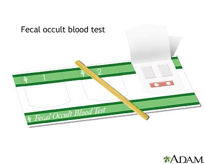 Common Uses of the 5 Stool Guaiac Test