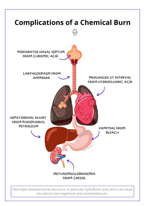 complications of chemical burns