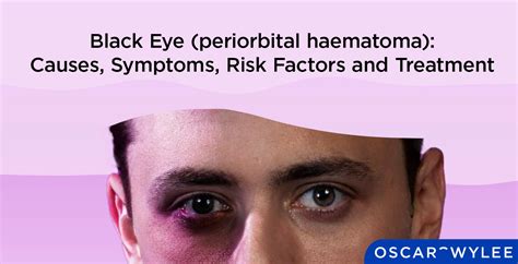 Complications of Black Eye