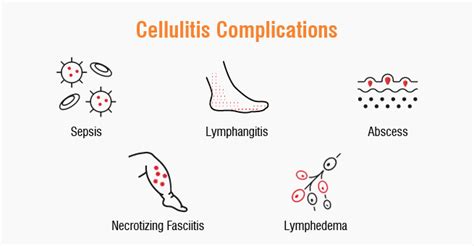 Complications of Cellulitis