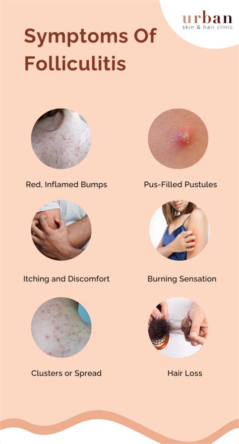 complications of folliculitis
