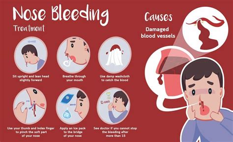Complications of Frequent Nosebleeds