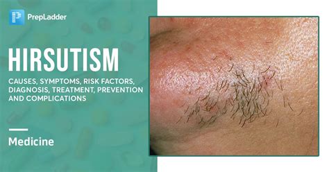 Complications of Hirsutism