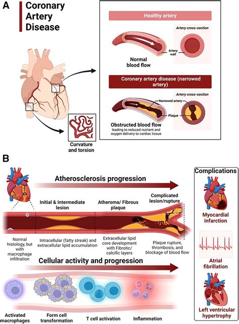 complications of hypertensive crisis