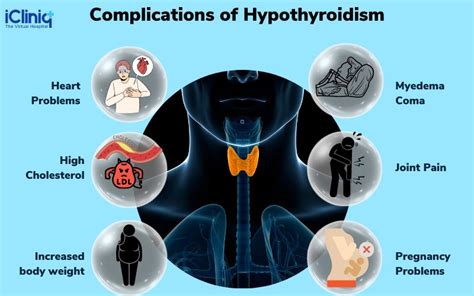 Complications of Hypothyroidism
