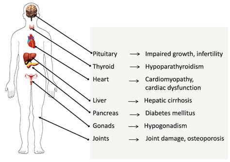 Complications of Iron Poisoning