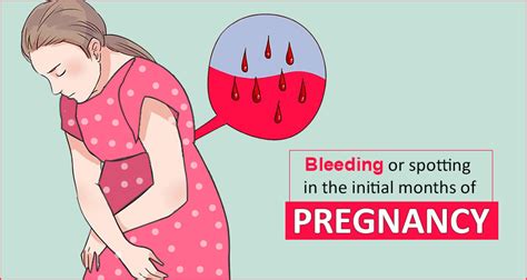 complications of light spotting during pregnancy