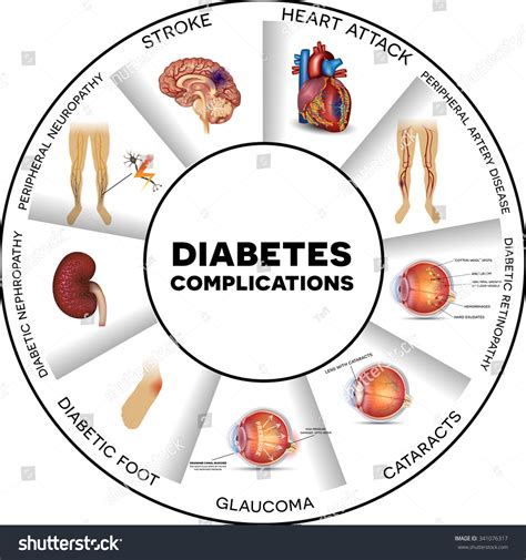 complications of unmanaged diabetes