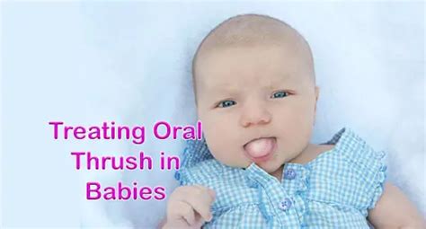 Complications of untreated thrush in babies